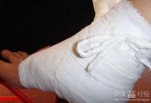 骨折打石膏过程视频,骨折康复关键步骤解析